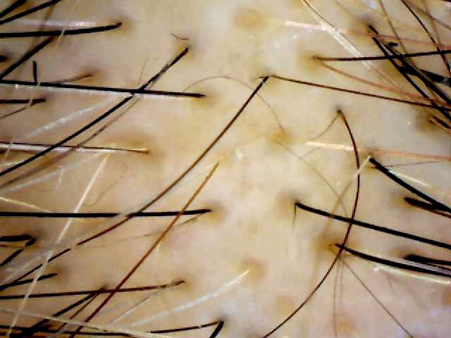 Before treatment