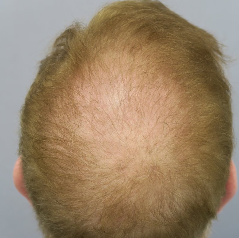 Four months after treatment