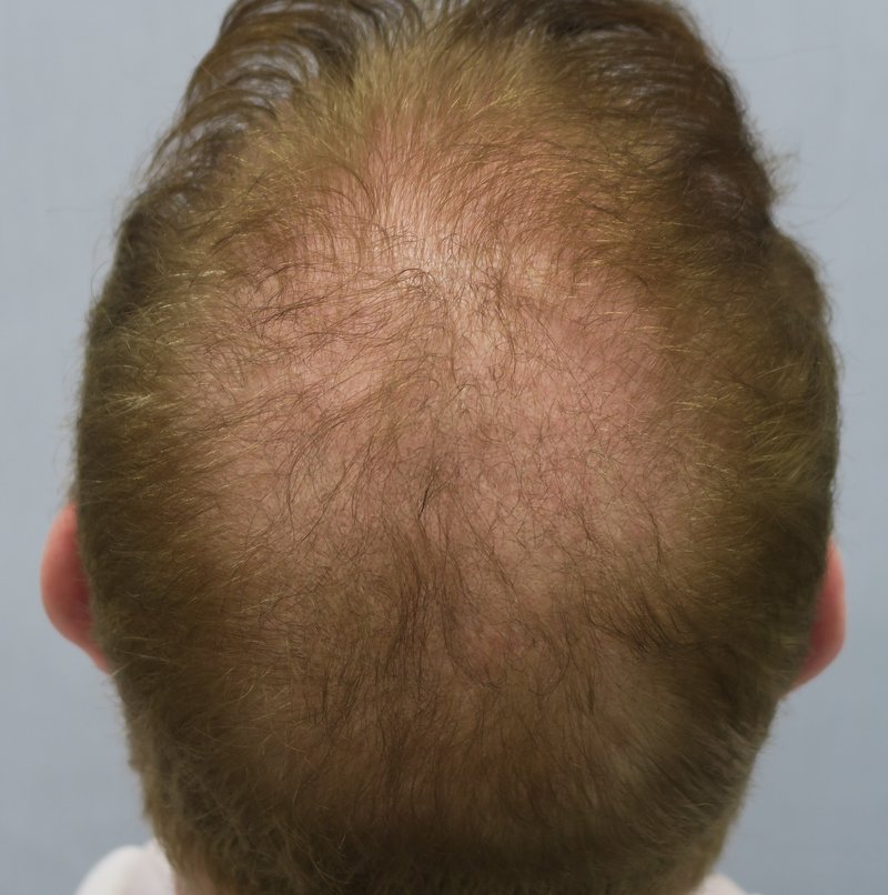 Six months after treatment