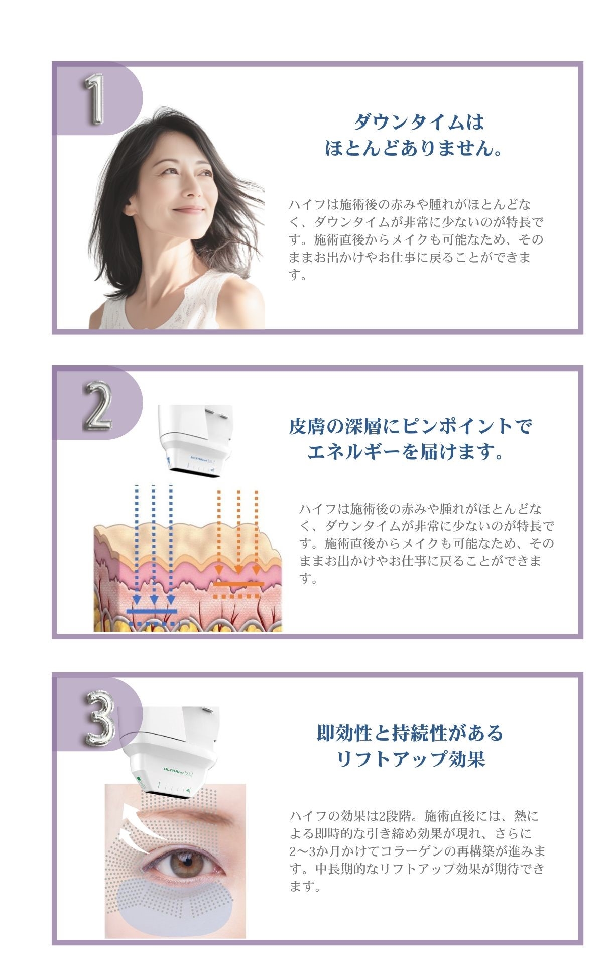 ハイフアイ特徴