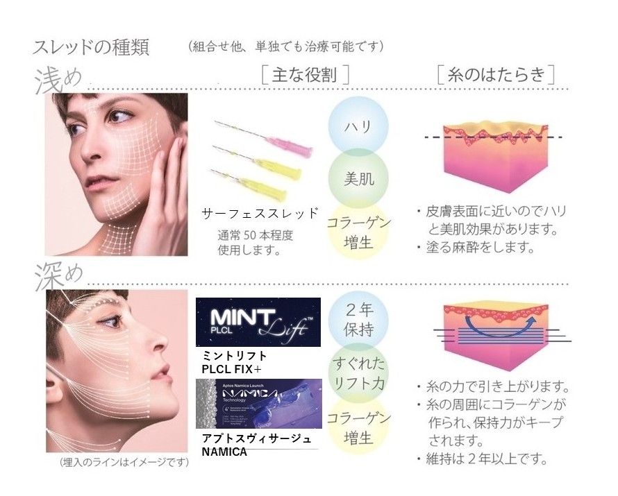 スレッドの種類 浅めタイプと深めタイプの主な役割と糸のはたらき
