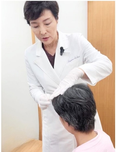 ウィンセル育毛